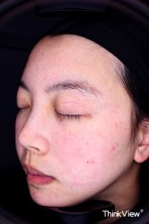 -Yestar重庆艺星医疗美容医院