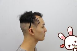 -大麦微针植发丨全国连锁