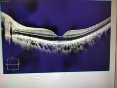-大连何氏眼科医院