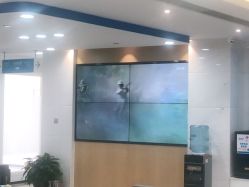 体验后-雍禾植发全国连锁