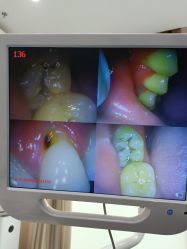 体验前-圣嘉新医疗美容医院