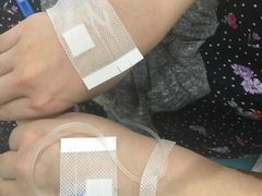 实习护士练手-上海市第五人民医院