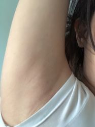 -薇兰专业脱毛连锁机构