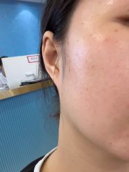 -长沙雅美医疗美容医院
