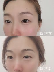 -西施无菌半永久纹绣眉眼影唇轻增发纹发际线