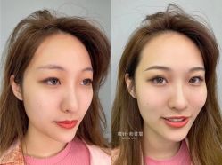 -babiline芭比莱恩半永久纹眉纹唇发际线