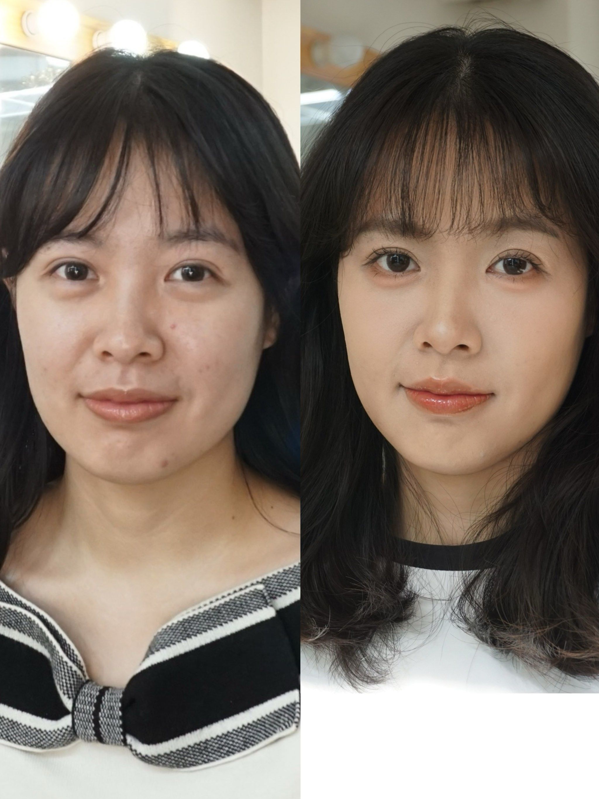 微整形小变化大