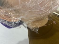 -广州美莱医疗美容医院