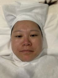 -苑苑vbeauty科技美容SPA