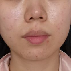 体验前-杭州医巢医疗美容
