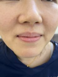 -长沙雅美医疗美容医院