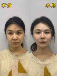 -上海伊莱美医疗美容医院