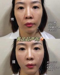 -Yestar艺星医疗美容医院