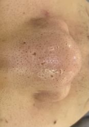 -SKIN79皮肤管理中心