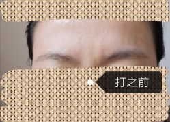 -洁铭新加坡医美