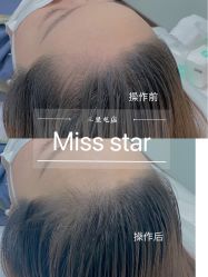 -MISS STAR·半永久纹眉·发际线·美瞳线