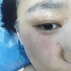 -一美医疗美容