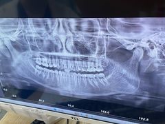 -同步齿科·数字化正畸种植口腔中心(珠海店)