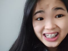 -柏乐口腔(南宁总院)