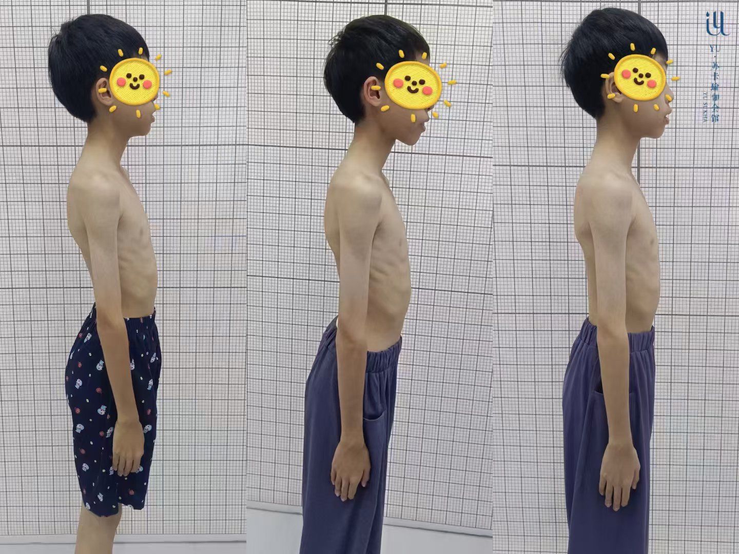 ‮文力‬老‮私师‬教理疗
青少年‮