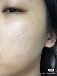 -苗方清颜痘肌研究所