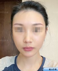 -圣嘉新医疗美容医院