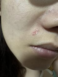 -深圳阳光医疗美容医院·旗舰店