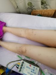 -清媚减肥瘦身纤体