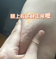-Lily纤美·科技减脂中心