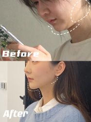 -八大处整形