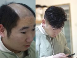 -发饰美男士增发补发假发定制店