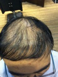 -髻尚坊增发补发织发假发定制