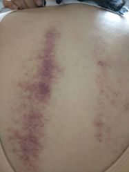 -靓靓伊人SKINCARE肌肤管理FACIAL·SPA