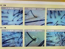 -丝客富脱发养发头皮馆