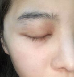 -纯粹医美