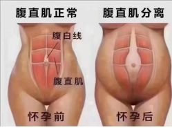 -Lily纤美·科技减脂中心