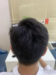 -大麦微针植发丨全国连锁