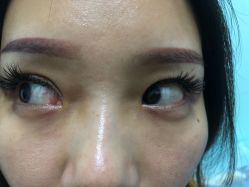 -痣清宫祛斑祛痣连锁店