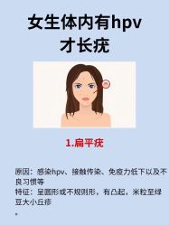 -美丽人生祛斑扁平疣汗管瘤中心