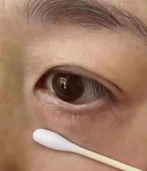 -北京美痣堂古方祛痣斑疣瘊
