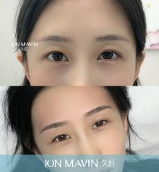 -久匠半永久纹眉
