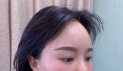 体验后-重庆联合丽格第五医疗美容医院