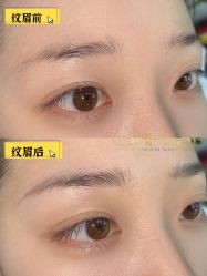 点击看大图 -OnFaer.纹眉半永久无创洗眉