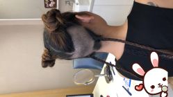 -大麦微针植发丨全国连锁