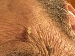 -复旦大学附属华山医院(总院)