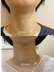 -上海漾颜医疗美容
