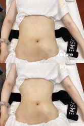 -雯婷·美容养生