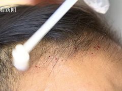 -淞南镇社区卫生服务中心