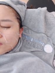 体验后-广西颜白玉医疗美容门诊部