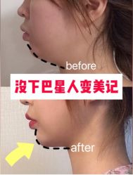 -上海漾颜医疗美容